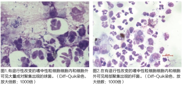 炎性皮肤病变的细胞学